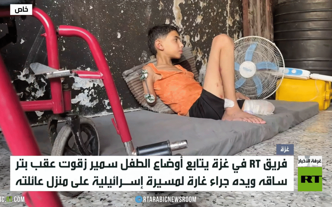 أطفال غزة.. مواجهة الجوع وبتر الأطراف