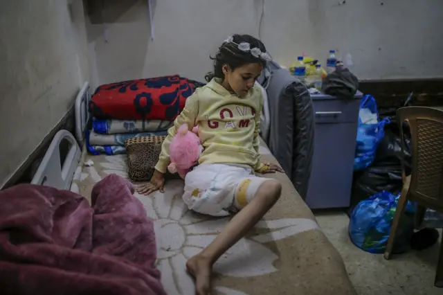 صورة أرشيفية لهبة مهنّا، وهي طفلة فلسطينية خسرت ساقها ووالدها في غارة إسرائيلية بمخيم النصيرات وسط القطاع (كانون الأول/كانون الأول 2024)