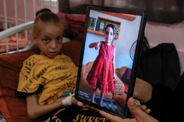 Palestinian girl Huda Abu Al-Naja lies on a bed receiving treatment at the malnutrition ward at Nasser hospital as her mother Sumayya shows an image of Huda when she was healthier, in Khan Younis, southern Gaza Strip, آب 5, 2025. REUTERS/Hatem Khaled