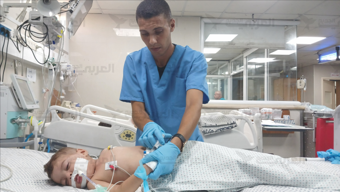 أوبئة وأمراض غير مألوفة تنتشر بين أطفال غزة