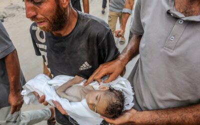 7 شهداء بيوم واحد في غزة جراء التجويع وتحذيرات من تفاقم الوضع