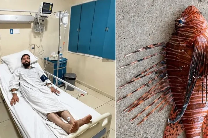 لدغة سمكة في بحر صور كادت تودي بحياته